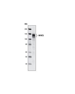 Cell Signaling Nfat3 (31g6) Rabbit mAb
