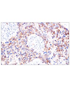Cell Signaling P-Cadherin (C13f9) Rabbit mAb
