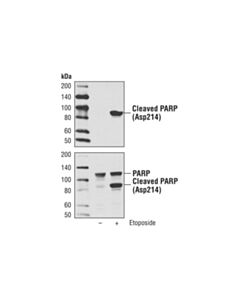 Cell Signaling Etoposide