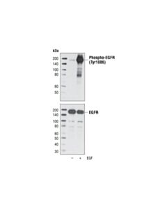 Cell Signaling Phospho-Egf Receptor (Tyr1086) Antibody