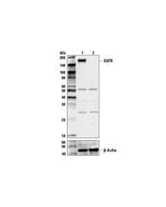 Cell Signaling Egf Receptor Antibody