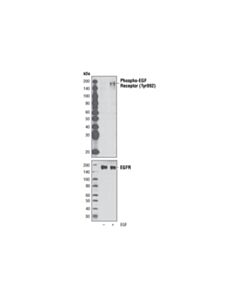 Cell Signaling Phospho-Egf Receptor (Tyr992) Antibody