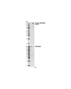 Cell Signaling Phospho-Her2/Erbb2 (Tyr877) Antibody