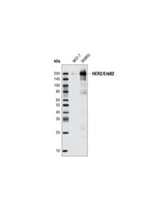 Cell Signaling Her2/Erbb2 Antibody