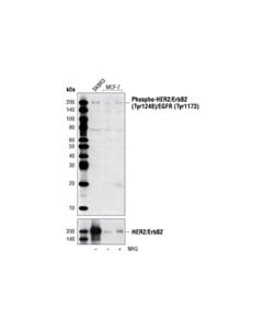Cell Signaling Phospho-Her2/Erbb2 (Tyr1248)/Egfr (Tyr1173) Antibody