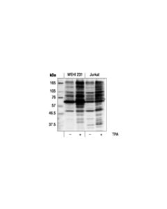Cell Signaling Phospho-(Ser) Pkc Substrate Antibody