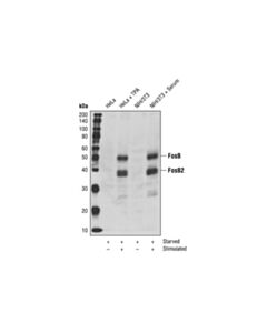 Cell Signaling Fosb Antibody