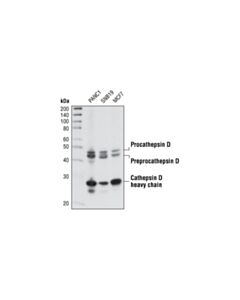 Cell Signaling Cathepsin D Antibody