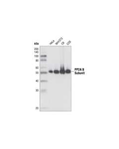 Cell Signaling Pp2a B Subunit (100c1) Rabbit mAb