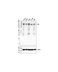 Cell Signaling Tie1 (D2k2t) Rabbit mAb