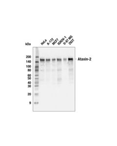 Cell Signaling Ataxin-2 (E3B3Z) Rabbit mAb (BSA and Azide Free)