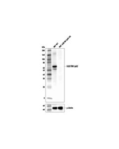 Cell Signaling Sqstm1/P62 (D6m5x) Rabbit mAb