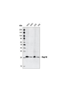 Cell Signaling Rap1B (36E1) Rabbit mAb 20 uL