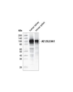 Cell Signaling Ae1/Slc4a1 (D3x1r) Rabbit mAb