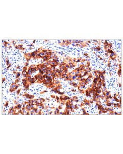 Cell Signaling Fgf Receptor 2 (D4l2v) Rabbit mAb