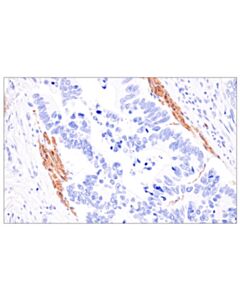 Cell Signaling Aspartoacylase (F8X9Z) Rabbit mAb (IHC/IF Formulated)