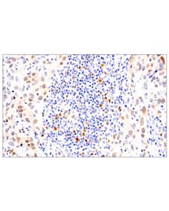 Cell Signaling Chk1 (2g1d5) Mouse mAb