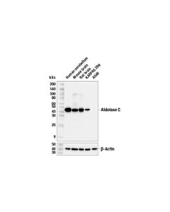 Cell Signaling Aldolase C (E7T4G) Mouse mAb 20 uL
