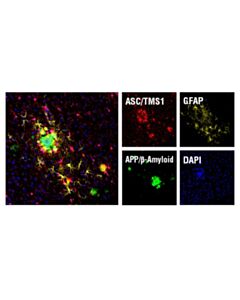 Cell Signaling Asc/Tms1 (D2w8u) Rabbit mAb (Mouse Specific) (Alexa Fluor 647 Conjugate)