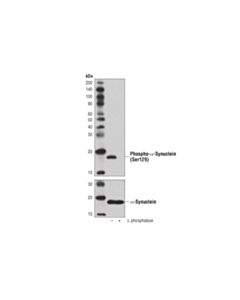 Cell Signaling Phospho-alpha-Synuclein (Ser129) (D1R1R) Rabbit Monoclonal Antibody