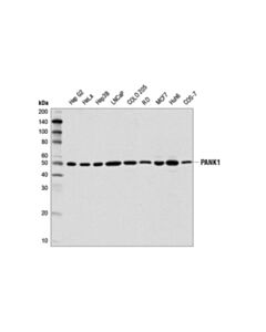 Cell Signaling Pank1 (D2w3n) Rabbit mAb