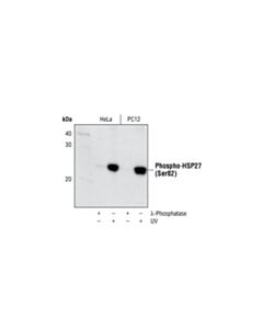 Cell Signaling Phospho-Hsp27 (Ser82) Antibody Ii