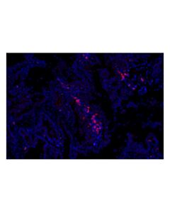 Cell Signaling CCR4 (F9A9K) Rabbit mAb (Alexa Fluor ® 647 Conjugate)