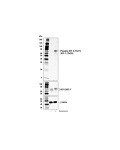 Cell Signaling Phospho-Atf-2 (Thr71)/Atf-7 (Thr53) Antibody