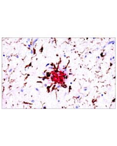 Cell Signaling App/Beta-Amyloid (Nab228) Mouse mAb