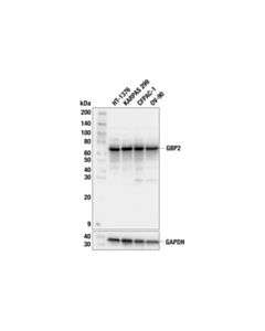 Cell Signaling GBP2 (F5H3U) Rabbit mAb; 20 µl