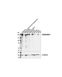 Cell Signaling Cd206/Mrc1 (E6t5j) Xp Rabbit mAb