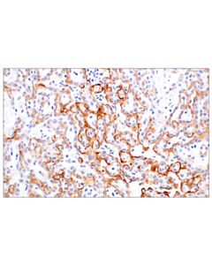 Cell Signaling UPK3B (DBRRM3.66) Rabbit mAb