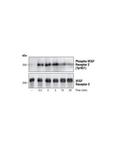 Cell Signaling Phospho-Vegf Receptor 2 (Tyr951) Antibody