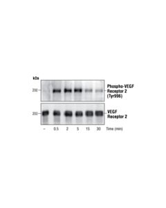 Cell Signaling Phospho-Vegf Receptor 2 (Tyr996) Antibody