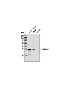 Cell Signaling Psa/Klk3 (D11e1) Xp Rabbit mAb