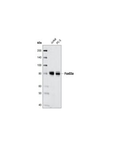 Cell Signaling Foxo3a (75d8) Rabbit mAb