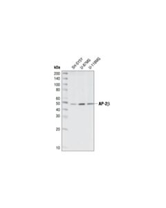 Cell Signaling Ap-2beta Antibody