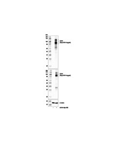 Cell Signaling Tnfrsf8/Cd30 (E7e4d) Xp Rabbit mAb