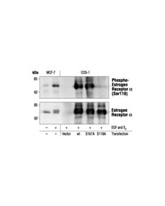 Cell Signaling Phospho-Estrogen Receptor Alpha (Ser118) (16j4) Mouse mAb