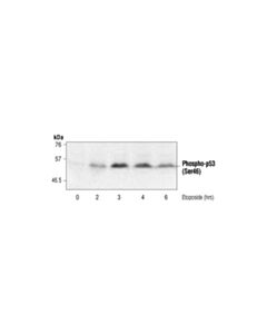 Cell Signaling Phospho-P53 (Ser46) Antibody
