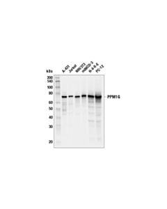 Cell Signaling Ppm1g (E7j2f) Rabbit mAb