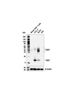 Cell Signaling TIGIT (E6Q3G) Rabbit mAb 20 uL