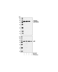Cell Signaling Phospho-P53 (Ser33) Antibody