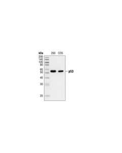 Cell Signaling P53 (7f5) Rabbit mAb