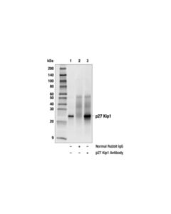 Cell Signaling P27 Kip1 Antibody