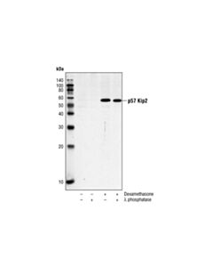 Cell Signaling P57 Kip2 Antibody