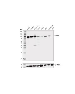 Cell Signaling Stat5 (D3n2b) Rabbit mAb