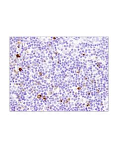 Cell Signaling Lag3 (D2g4o) Xp<LT/>Sup&Gt;®<LT/>/Sup&Gt; Rabbit mAb (BSA And Azide Free)