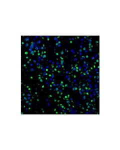 Cell Signaling Tunel Assay Kit (Fluorescence, 488 Nm)
