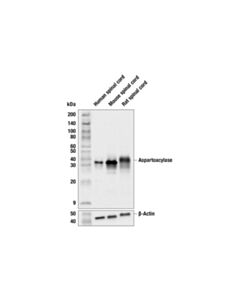 Cell Signaling Aspartoacylase (F8X9Z) Rabbit mAb